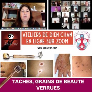 Atelier Zoom 025 « Taches, Grains de Beauté et Verrues »